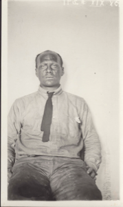 Image of Elmer Ekblaw, portrait. Note skin condition